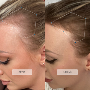 Ultra růstové duo Advanced+