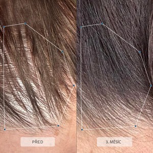 Vitamíny 35+ s přidaným kolagenem